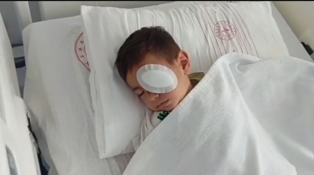Söke’de  sokak köpeği saldırısına uğrayan 3 yaşındaki çocuk hastaneye kaldırıldı